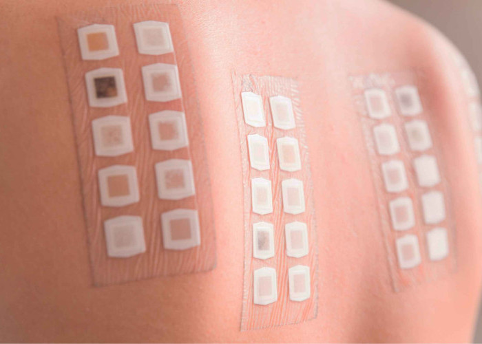 Patch Test Skincare: Cara Aman Coba Produk Baru