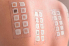 Patch Test Skincare: Cara Aman Coba Produk Baru